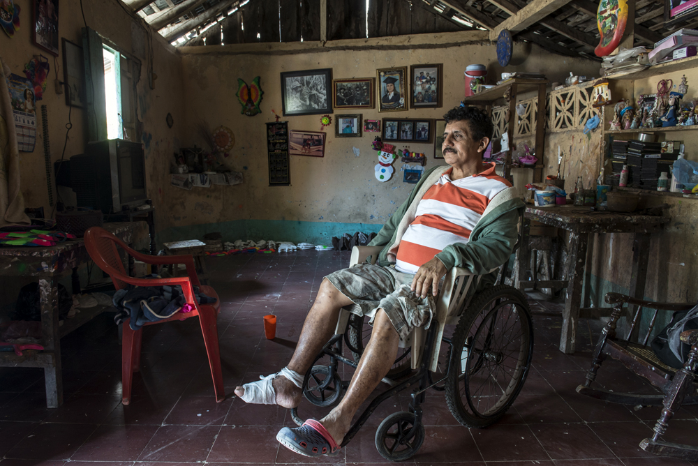 Alberto Bracamontes, ex Cachorro del BLI Santos López, sufre hoy de diabetes y hace poco le amputaron dos dedos del pie. Foto: Óscar Navarrete / La Prensa.